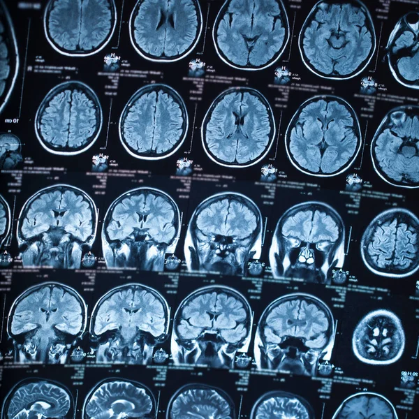 Radiografía Médica Del Cerebro Humano Imagen Primer Plano — Foto de Stock