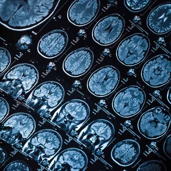 İnsan beyninin, portre resim tıbbi x-ray