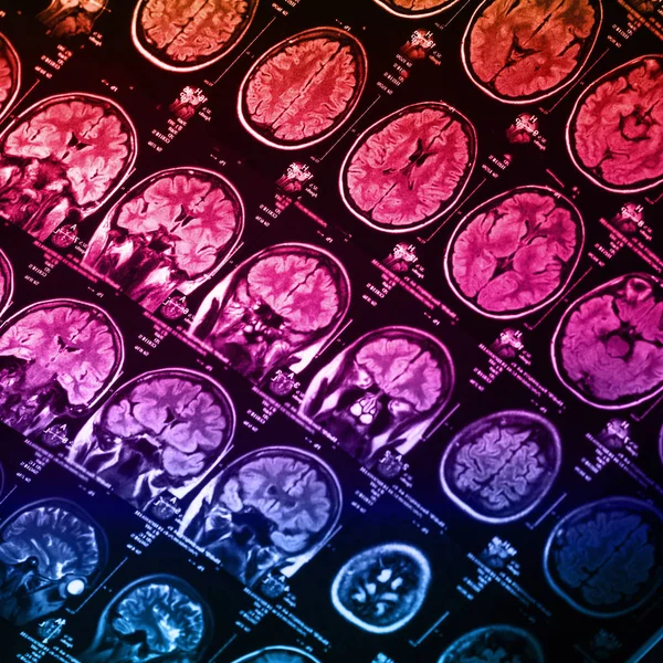 İnsan beyninin, portre resim tıbbi x-ray