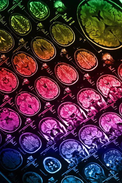 İnsan beyninin, portre resim tıbbi x-ray