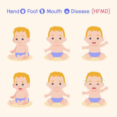 Bebek Çocuklar enfekte ve sağlıklı Set, Boy bir El Ayak Ağız Hastalığı var, Yağmur sezonunda Hfmd, Tıbbi Sağlık kavramı, çizgi film karakteri vektör Bilgi-grafik.