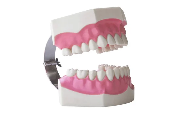 Dentaduras Modelo Dentes Dentários Goma Clara Para Ciência Médica — Fotografia de Stock