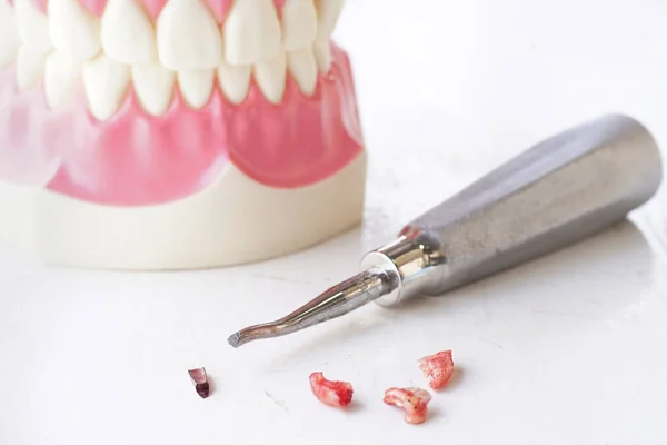 Broken Dentist Tools Teeth Model Pieces Teeth Blood Stain White — Stock Photo, Image