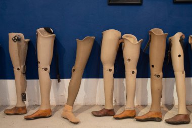 Uzuv kaybı için yapay bacaklar