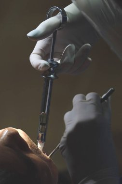 Dişçi hastaya anestezi enjekte ediyor.