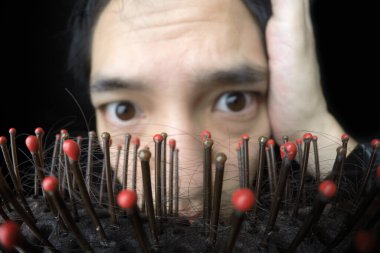 Close up hairloss on comb. Asian man with worry expression in the background clipart
