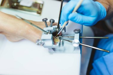 Onun hasta pedikür tedavi veren Doktor uzman. Seçici odak.