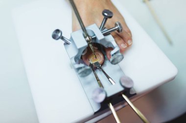 Hastasına pedikür tedavisi veren doktor uzmanı.