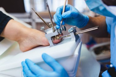 Onun hasta pedikür tedavi veren Doktor uzman. Seçici odak.