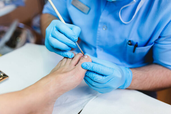 Doctor specialist giving pedicure treatment to his patient. Selective focus.
