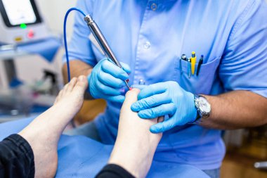 Laser tırnak tedavisi kliniğinde ayak lazeriyle ayak mantarı tedavisi..