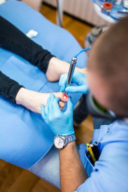 Laser tırnak tedavisi kliniğinde ayak lazeriyle ayak mantarı tedavisi.