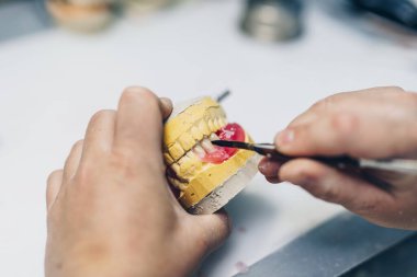 Diş protezi. Takma diş üzerinde çalışırken ellerinizi kapatın. Seçici odak.