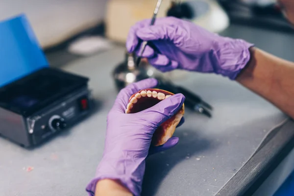 假牙工作 假牙医生的手在假牙上工作 有选择的重点 — 图库照片