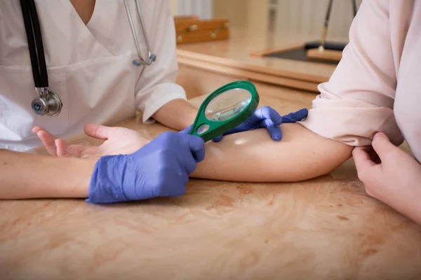 Dermatologis memeriksa tahi lalat pasien di lengan dengan kaca pembesar di klinik. Tutup. — Stok Foto