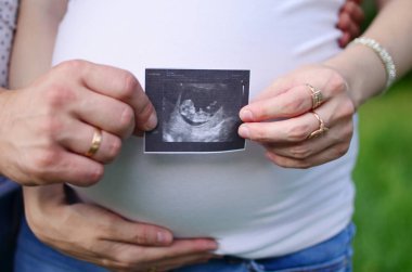 Hamile kadın ve erkeklerin ultrason karın üzerinde tutarak yakın çekim.