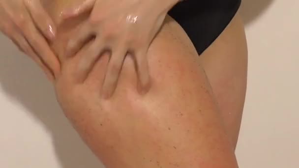 Woman Makes Cellulite Lymphatic Drainage Massage Upper Leg Her Hands — Stock Video