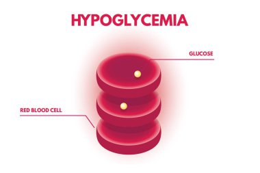 Hipoglisemi, izometrik insan glikoz düzeyleri. Vektör çizim.