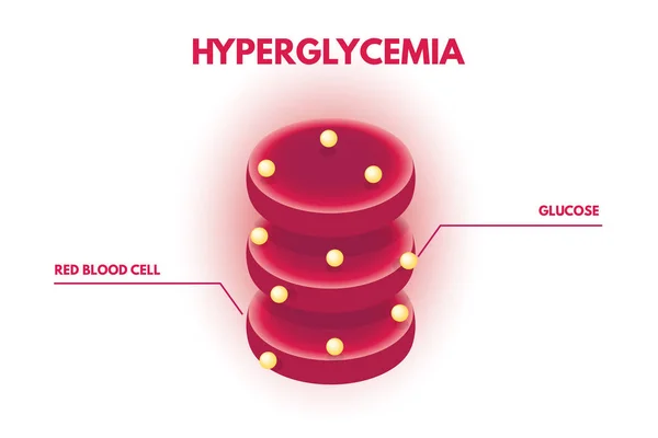 Hiperglucemia Niveles Glucosa Humana Isométrica Ilustración Vectorial — Vector de stock