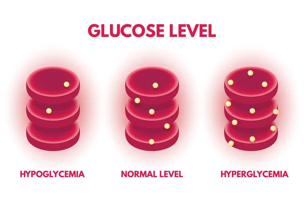 Hiperglucemia Hypjglycemia Niveles Isométricos Glucosa Humana Ilustración Vectorial — Vector de stock