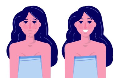 Lazer ya da asit soyma, kavram öncesi ve sonrası cilalama. Akne işareti. Kabataslak deri dokusu. Vektör illüstrasyonu.