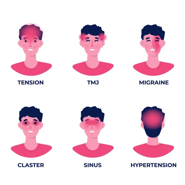 Hoofdpijntypen Verschillende Gebieden Van Patiëntenheadset Vectorillustratie — Stockvector