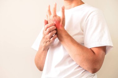 Kadın kaşıntıyı çiziyor. Hassas cilt, gıda alerjisi belirtileri, tahriş.