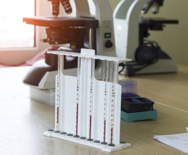 Esr mikroskoplar, ilaç ve kan, virüs nipah için kan testi