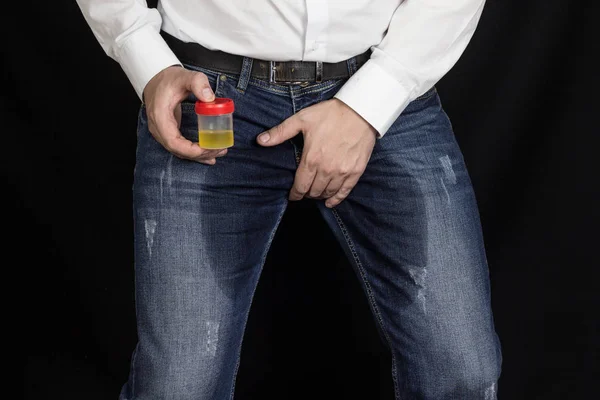 Um homem com uma análise de urina em suas mãos e calças molhadas fica em um fundo preto, incontinência, infecções sexuais — Fotografia de Stock