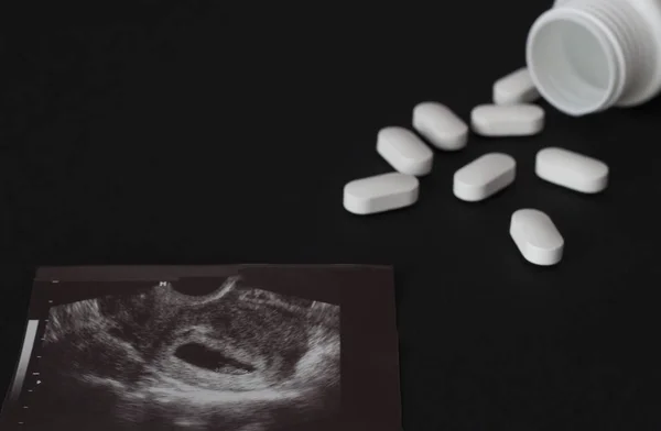 Снимок беременности Узи и таблетки с банкой, черный фон — стоковое фото