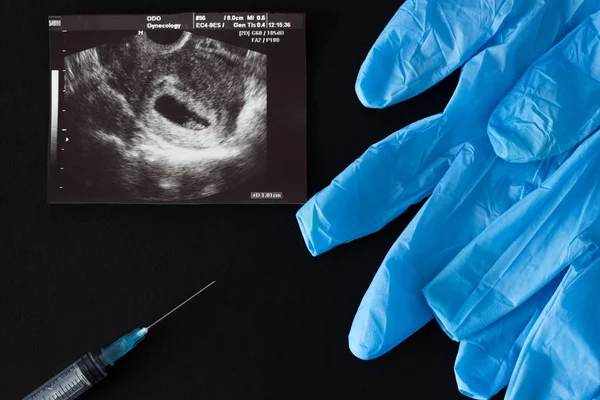 Abtreibung, Schwangerschaftstest, medizinische Handschuhe und Spritze, schwarzer Hintergrund — Stockfoto