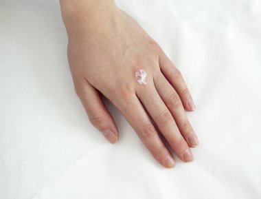 Yandan tahriş kızın krem