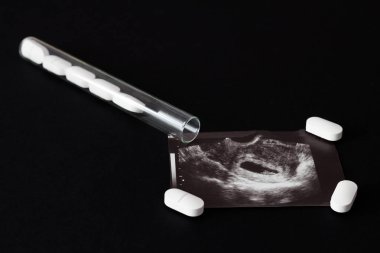 Uzi vurdu, hap ve tüp bir siyah arka plan, kürtaj, yakın çekim