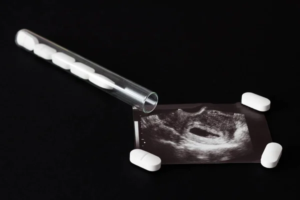 Узи выстрел, таблетки и пробирка на черном фоне, аборт, крупный план — стоковое фото