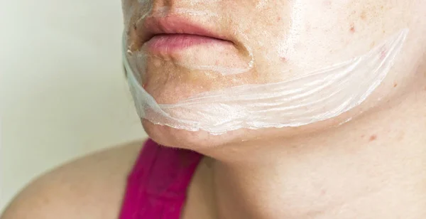 Pellicola di maschera per il viso della ragazza, pelle problematica, primo piano — Foto Stock