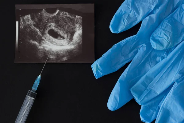 Ein Bild eines Uzi, einer Spritze, einer Abtreibung, medizinischer Handschuhe, einem schwarzen Hintergrund — Stockfoto