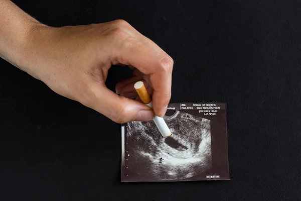 A woman\'s hand, a future mother extinguishes a cigarette on a picture of a pregnancy uzi, pregnancy and smoking, cigarette and pregnancy