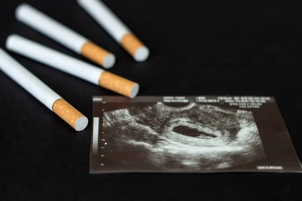 Cigarettes in the picture of pregnancy, pregnancy and smoking, cigarette