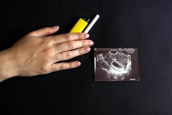 The future mother holds a cigarette and a lighter in her hand, next to a photograph of the pregnancy uzi, pregnancy and smoking, gestation