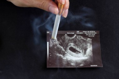 Bir kadın eli, gelecekte anne gebelik uzi, gebelik ve sigara, Sigara ve gebelik resmi üzerinde sigara söndürür.