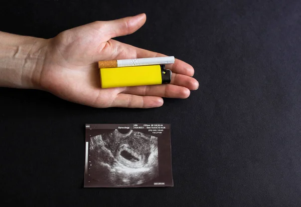 The future mother holds a cigarette and a lighter in her hand, next to a photograph of the pregnancy uzi, pregnancy and smoking, gestation