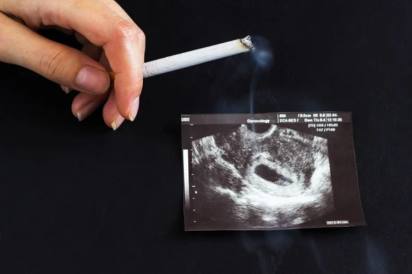 A woman\'s hand holds a burning cigarette against the background of a picture of the uzi of pregnancy, pregnancy and smoking, gestation