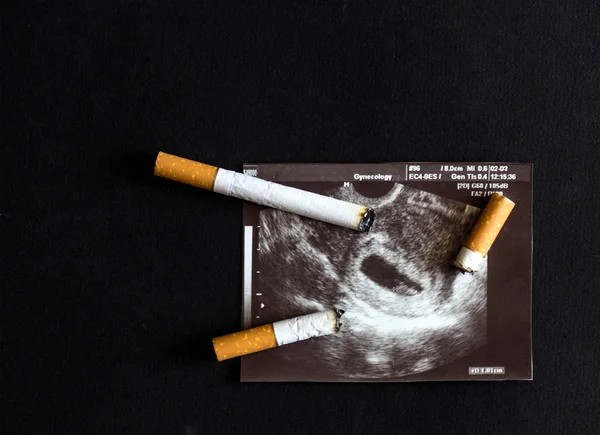 Cigarette cigarette stubs extinguished about a shot of pregnancy, pregnancy and smoking, cigarette and gestation