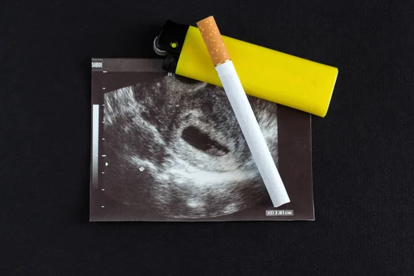 Cigarette and lighter lie on the picture of uzi pregnancy, smoking and pregnancy, gestation, black background