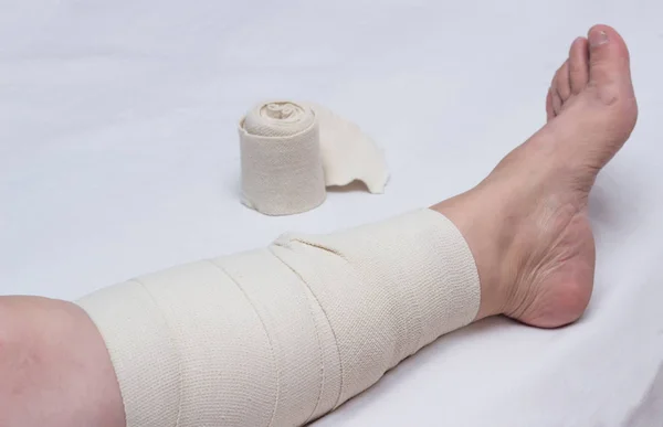 Opatrzył nogi Starsza kobieta z bandaż elastyczny przeciw żylaków nóg, zbliżenie, białe tło, phlebeurysm — Zdjęcie stockowe