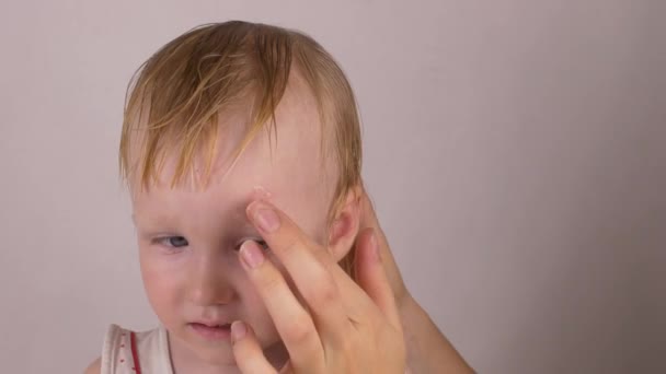 Mutter behandelt Narbenwunde auf der Stirn ihrer kleinen kaukasischen Tochter mit einer heilenden Creme gegen Allergien und Wundheilung, Nahaufnahme — Stockvideo