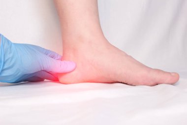 A doctor in medical gloves examines a patient's heel spur, pain in the foot and heel, plantar fasciitis, close-up clipart