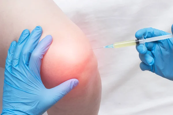 El médico inyecta plasma en una rodilla femenina dolorida e inflamada para artrosis y artritis, elevación de plasma, primer plano, médico, profesional — Foto de Stock