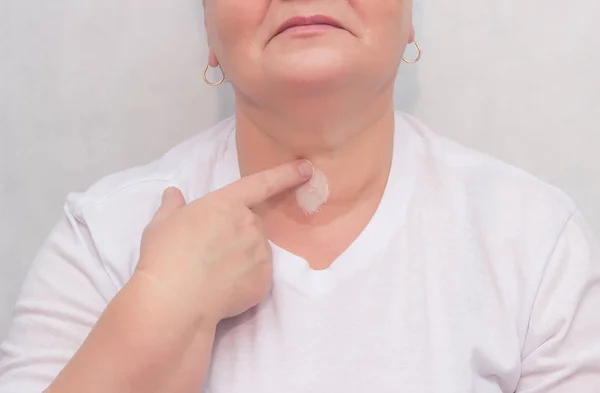 Woman rubs therapeutic cream-gel for the thyroid gland, treatment of the thyroid gland, close-up, medicinal — Stock Photo, Image