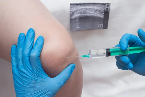 A doctor injects a medical injection of chondroprotector and hyaluronic acid into the knee of a woman to restore the knee joint, cartilage and synovial fluid, close-up — Stock Photo, Image